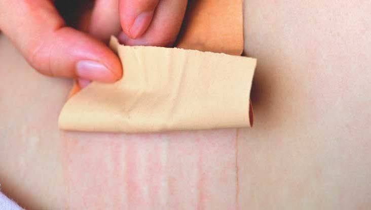 how-to-apply-transdermal-patch | How to Apply a Dab Patch Correctly